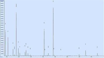 Amino Acids of Seminal Plasma Associated With Freezability of Bull Sperm